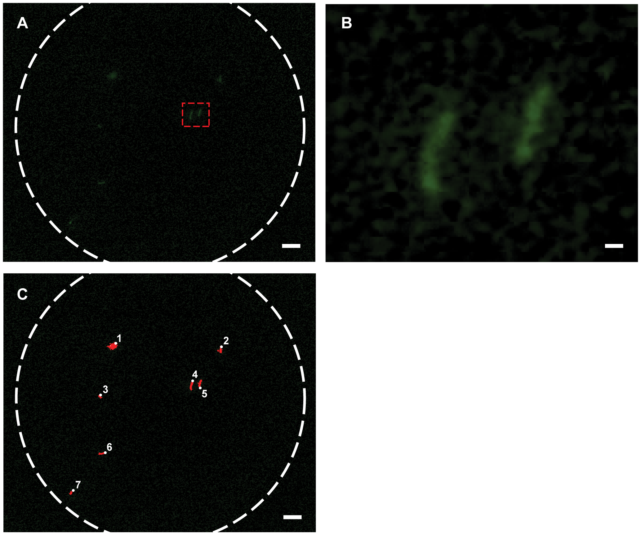 PLOS Figure 3: fluorescence mobile phone microscopy images of tuberculosis in sputum